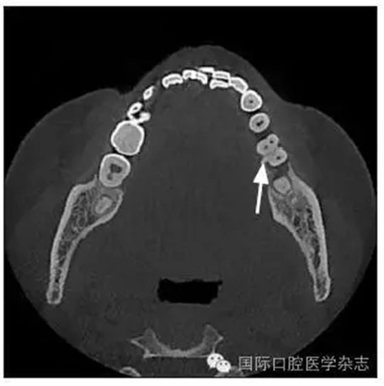 640.webp.jpg 640.webp.jpg