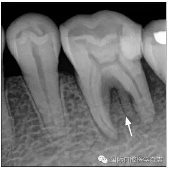 640.webp (3).jpg 640.webp (3).jpg