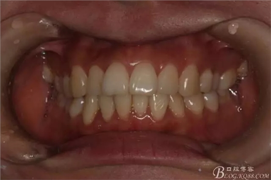 640.webp.jpg 640.webp.jpg