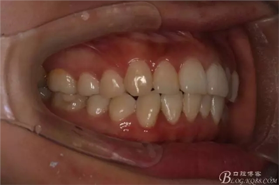 640.webp (1).jpg 640.webp (1).jpg