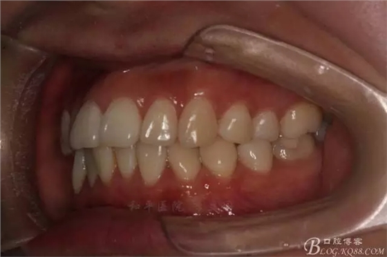 640.webp (2).jpg 640.webp (2).jpg