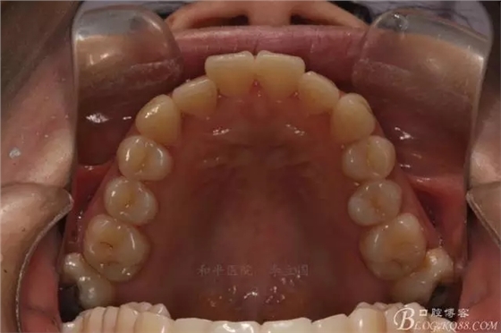 640.webp (3).jpg 640.webp (3).jpg