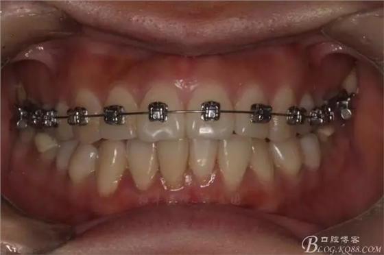 640.webp (5).jpg 640.webp (5).jpg