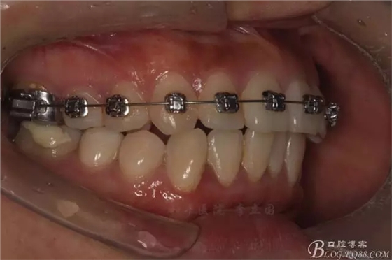 640.webp (6).jpg 640.webp (6).jpg