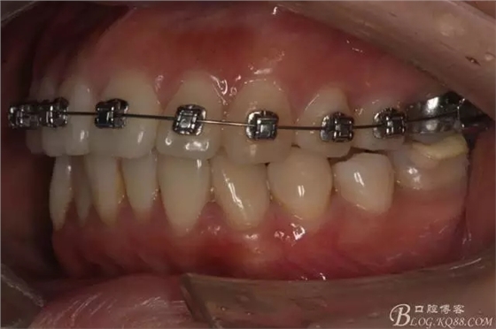 640.webp (7).jpg 640.webp (7).jpg