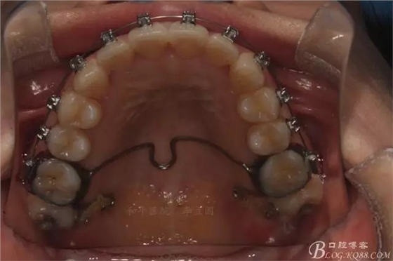 640.webp (8).jpg 640.webp (8).jpg