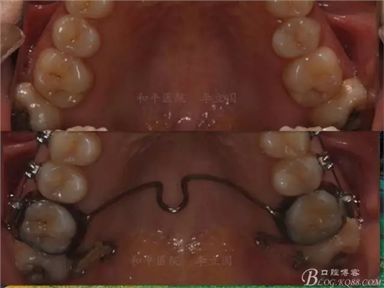 640.webp (9).jpg 640.webp (9).jpg