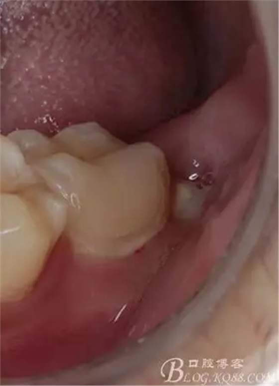 640.webp (11).jpg 640.webp (11).jpg