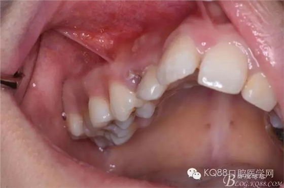 640.webp (1).jpg 640.webp (1).jpg