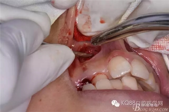 640.webp (5).jpg 640.webp (5).jpg