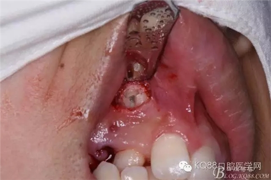 640.webp (10).jpg 640.webp (10).jpg