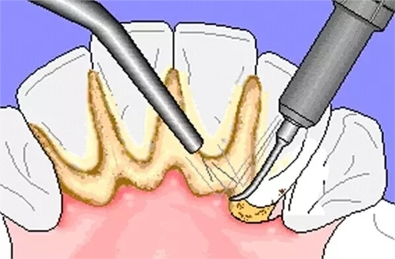 640 (2).webp (1).jpg 640 (2).webp (1).jpg