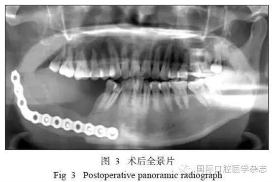 640.webp (11).jpg 640.webp (11).jpg
