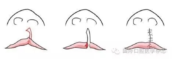 640.webp.jpg 640.webp.jpg