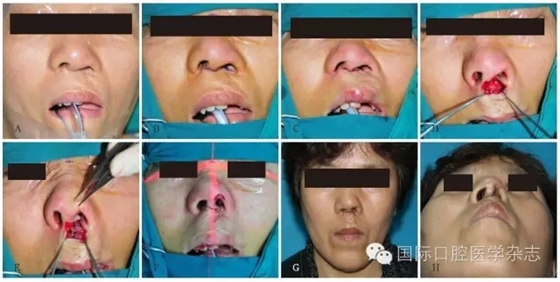 640.webp (3).jpg 640.webp (3).jpg