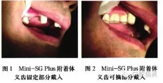 640.webp (6).jpg 640.webp (6).jpg