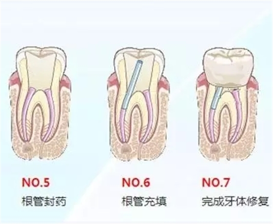 640.webp (4).jpg 640.webp (4).jpg