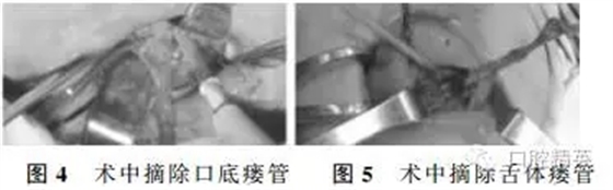 640.webp (2).jpg 640.webp (2).jpg