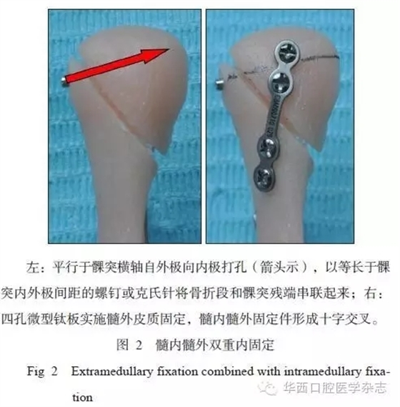 640.webp (17).jpg 640.webp (17).jpg