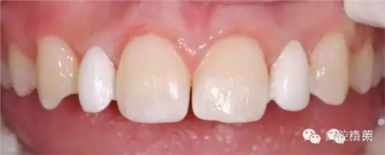 640.webp (10).jpg 640.webp (10).jpg