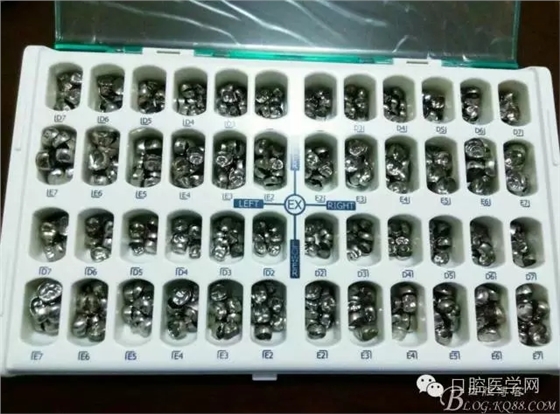 乳磨牙金屬預成冠制作 乳磨牙金屬預成冠制作