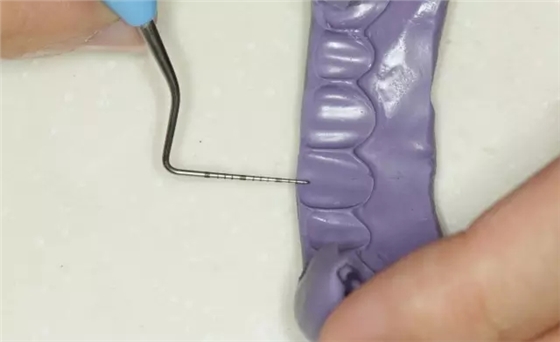 硅橡膠導(dǎo)板&mdash;&mdash;牙體預(yù)備步驟詳解