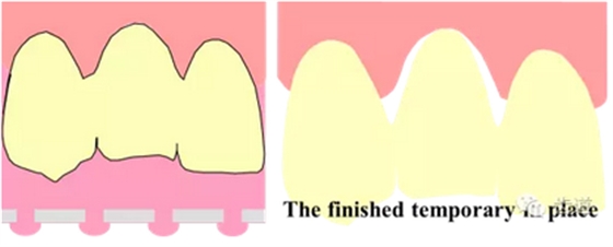 QQ圖片20161111160856.png QQ圖片20161111160856.png