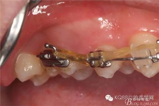 640.webp.jpg 640.webp.jpg