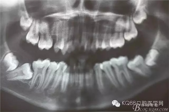 640.webp (2).jpg 640.webp (2).jpg