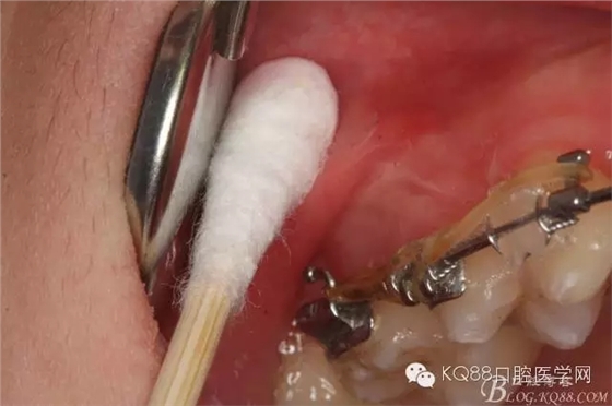 640.webp (4).jpg 640.webp (4).jpg