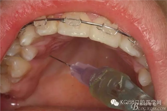 640.webp (6).jpg 640.webp (6).jpg