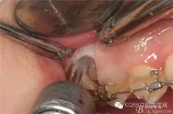 640.webp (11).jpg 640.webp (11).jpg