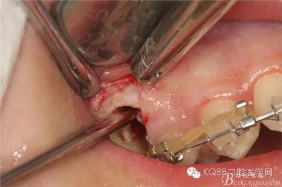 640.webp (13).jpg 640.webp (13).jpg