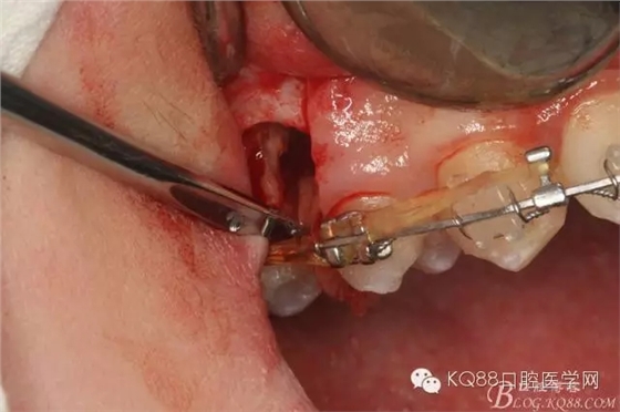 640.webp (14).jpg 640.webp (14).jpg