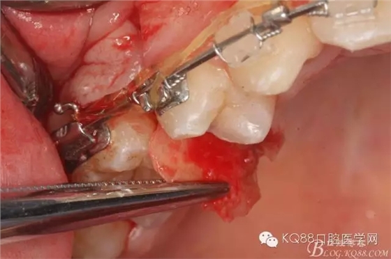 640.webp (15).jpg 640.webp (15).jpg