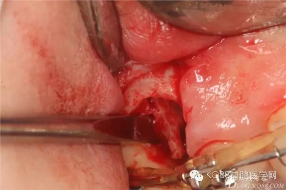 640.webp (16).jpg 640.webp (16).jpg