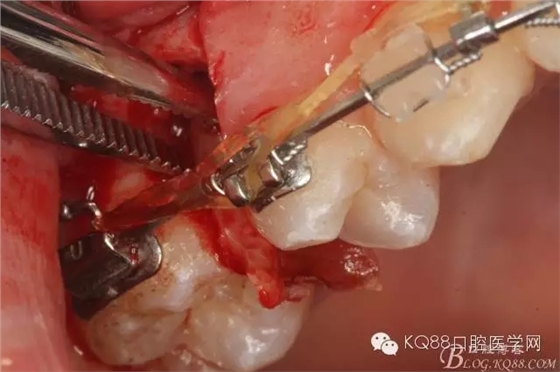 640.webp (17).jpg 640.webp (17).jpg