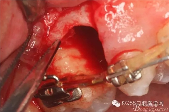 640.webp (19).jpg 640.webp (19).jpg