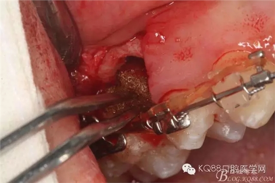 640.webp (20).jpg 640.webp (20).jpg