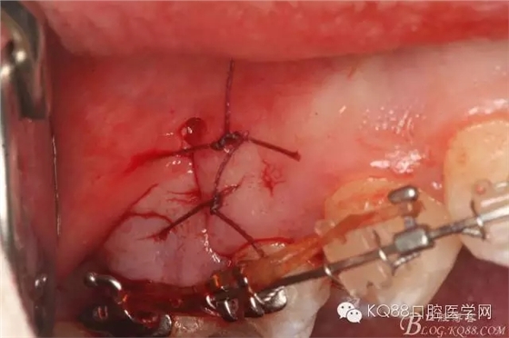 640.webp (21).jpg 640.webp (21).jpg