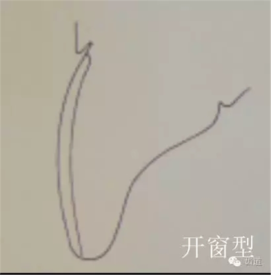 640.webp (9).jpg 640.webp (9).jpg