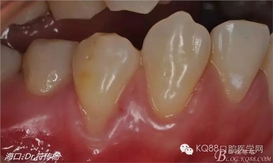 640.webp.jpg 640.webp.jpg