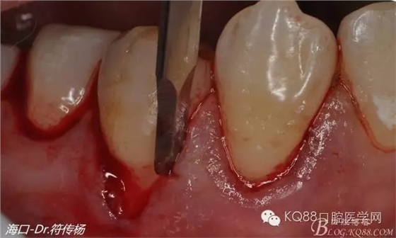 640.webp (4).jpg 640.webp (4).jpg