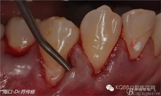 640.webp (11).jpg 640.webp (11).jpg