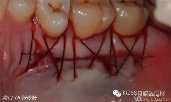 640.webp (14).jpg 640.webp (14).jpg