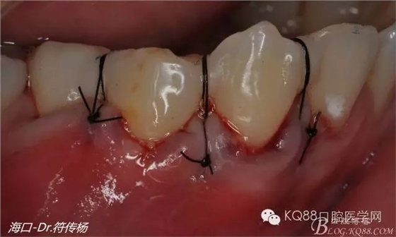 640.webp (15).jpg 640.webp (15).jpg