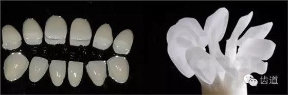 瓷貼面的粘接步驟及技術要點 瓷貼面的粘接步驟及技術要點