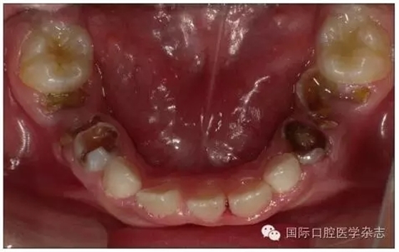 640.webp.jpg 640.webp.jpg