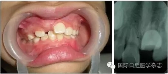 640.webp (3).jpg 640.webp (3).jpg