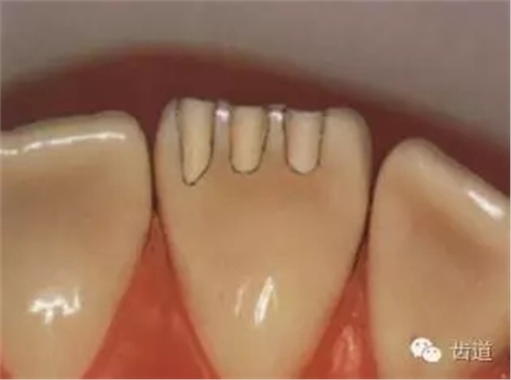 640.webp.jpg 640.webp.jpg